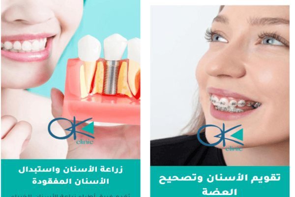 لماذا يجب أن تختار مركز أوكي كلينيك؟