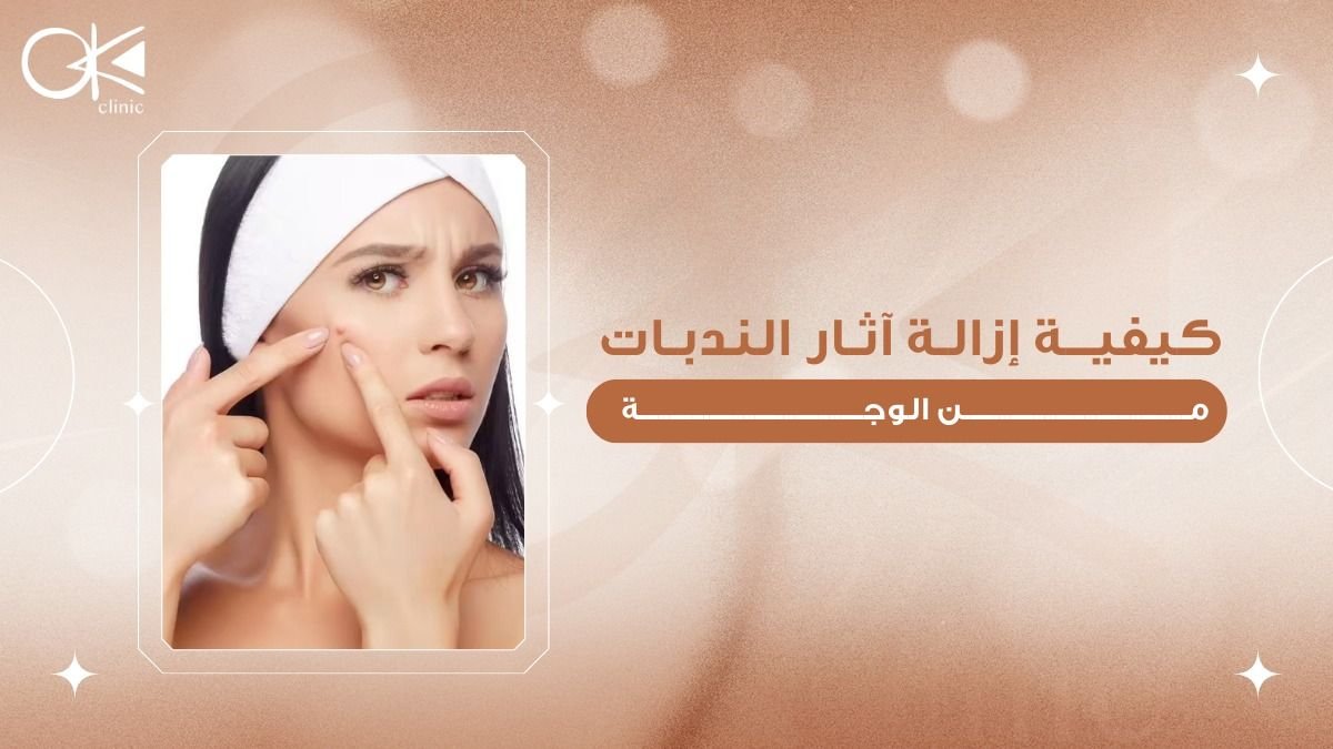 ازالة اثار الندبات من الوجه